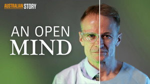 Still from An Open Mind - Professor Richard Scolyer